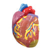 Hypertension Anatomy Model Set