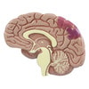 Hypertension Anatomy Model Set