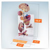 Hypertension Anatomy Model Set