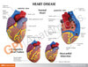 3 Piece Mini Heart Anatomy Models Set