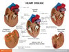 3 Piece Mini Heart Anatomy Models Set