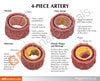 4 Piece Artery Anatomy Model
