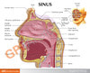 Basic Sinus Anatomy Model