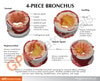 4 Piece Bronchus Anatomy Model