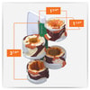 4 Piece Bronchus Anatomy Model