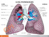 Healthy lung anatomy education card