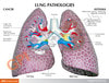 Healthy lung anatomy education card