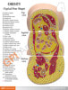 Obesity Anatomy Model