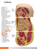 Obesity Anatomy Model