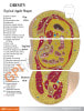 Obesity Anatomy Model