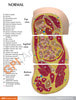 Obesity Anatomy Model