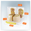 Obesity Anatomy Model