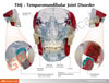 TMJ Clear Skull Anatomy Model - jaw back