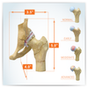 4-Stage Arthritic Hip Anatomy Model