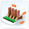 Gastroesophageal Reflux Disease Anatomy Model Gerd