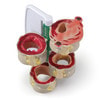 4-Piece Colon With Pathologies Anatomy Model