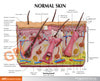 Skin Normal/Acne Anatomy Model