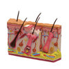 Skin Normal/Acne Anatomy Model
