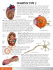 Type 2 Diabetes Anatomy Model