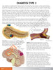 Type 2 Diabetes Anatomy Model