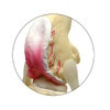 Canine 4-Stage Knee Anatomy Model