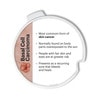 Skin Cancer Disk Set Anatomy Model