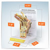 Rheumatoid Arthritis Hand Anatomy Model