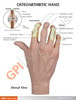 Osteoarthritis Hand Anatomy Model - education cards