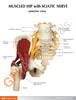 Muscled Hip with Sciatic Nerve Anatomy Model