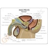 Male Pelvis with Benign Prostatic Hyperplasia Insert