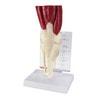 Muscled Joint Knee