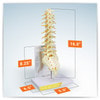 Thoracic and Lumbar Spine with Sacrum