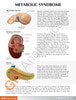 Metabolic Syndrome Anatomy Model Set - back