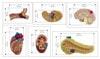 Metabolic Syndrome Anatomy Model Set