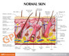 Aging Skin, Hair Loss and Normal Skin Anatomy Model