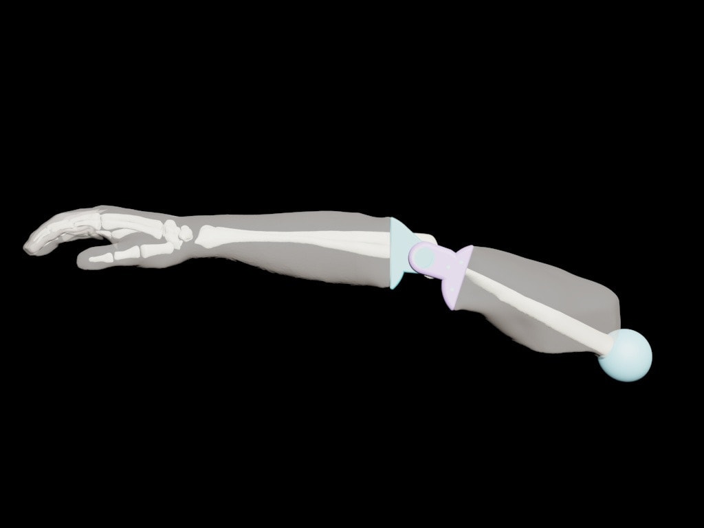 True Phantom True Phantom Adult Arm for X-Ray CT, US, MRI | Anatomy Warehouse