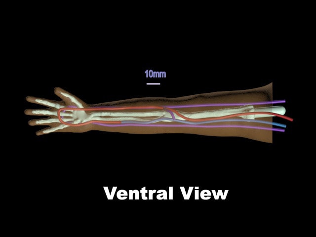 True Phantom True Phantom Newborn Arm for X-Ray CT, US, MRI | Anatomy Warehouse