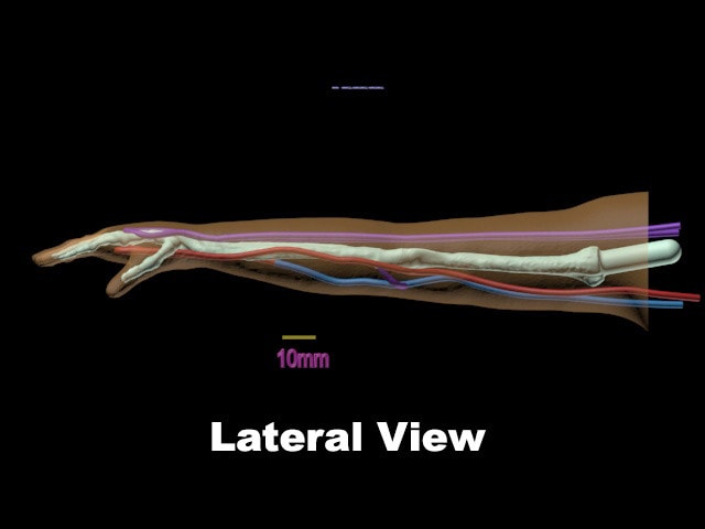 True Phantom True Phantom Newborn Arm for X-Ray CT, US, MRI | Anatomy Warehouse