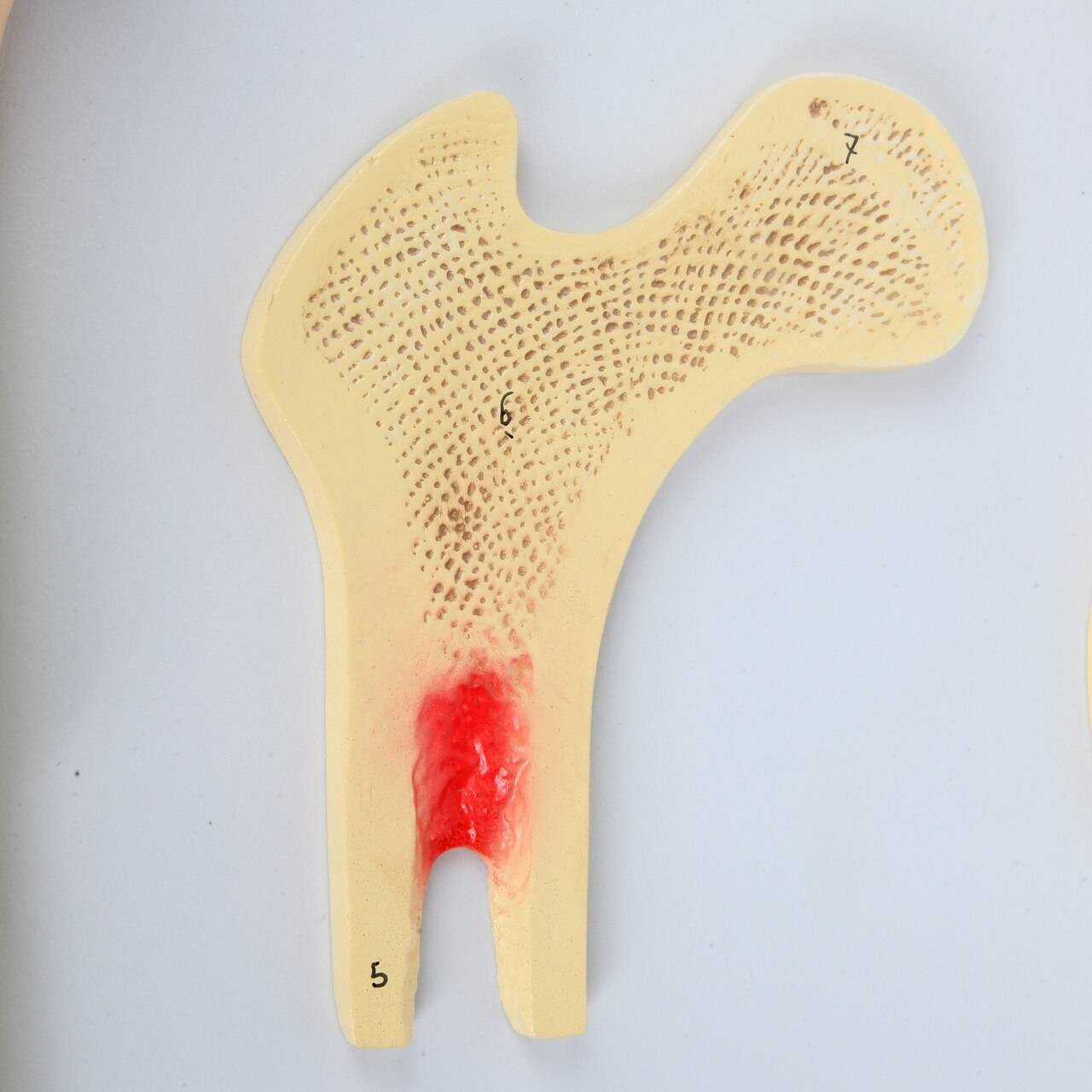 Axis Scientific Human Bone Microstructure with Long Bone Osteon
