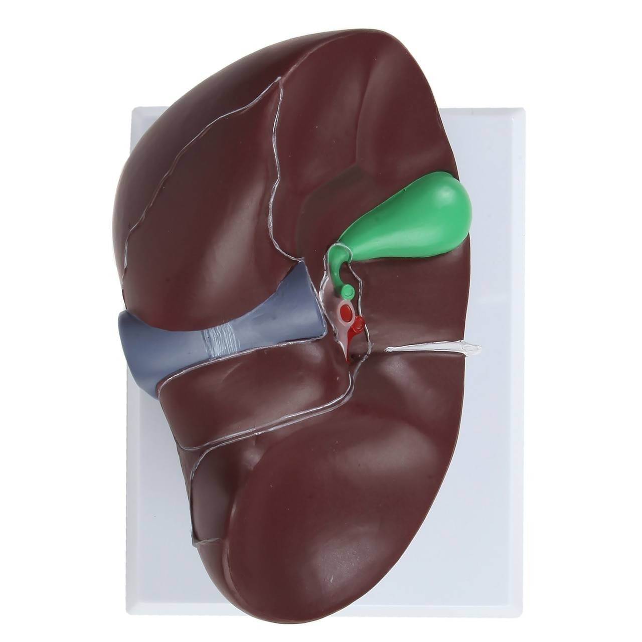 Axis Scientific Life-Size Human Liver Anatomy Model