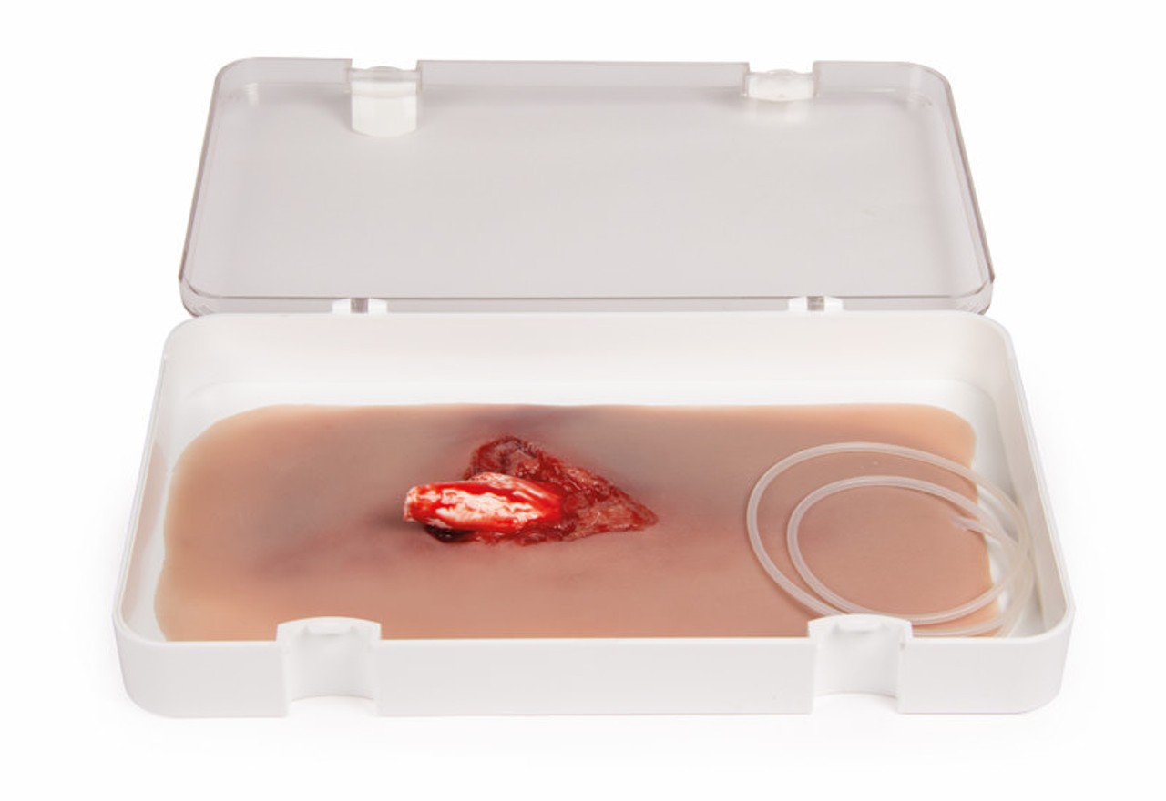 Leg Skin Moulage, Open Fracture Wound - Bleeding
