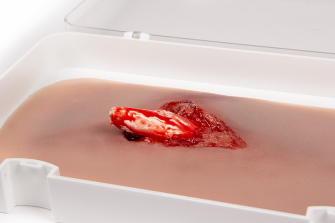 Leg Skin Moulage, Open Fracture Wound - Bleeding