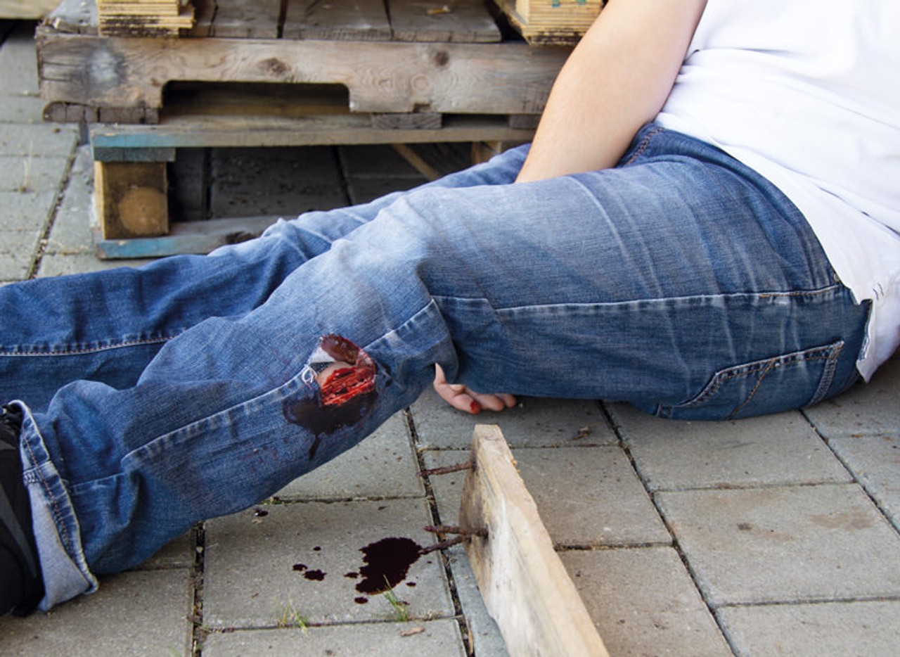 Skin Moulage, Cut Wound