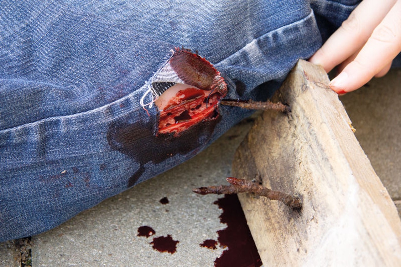 Skin Moulage, Cut Wound