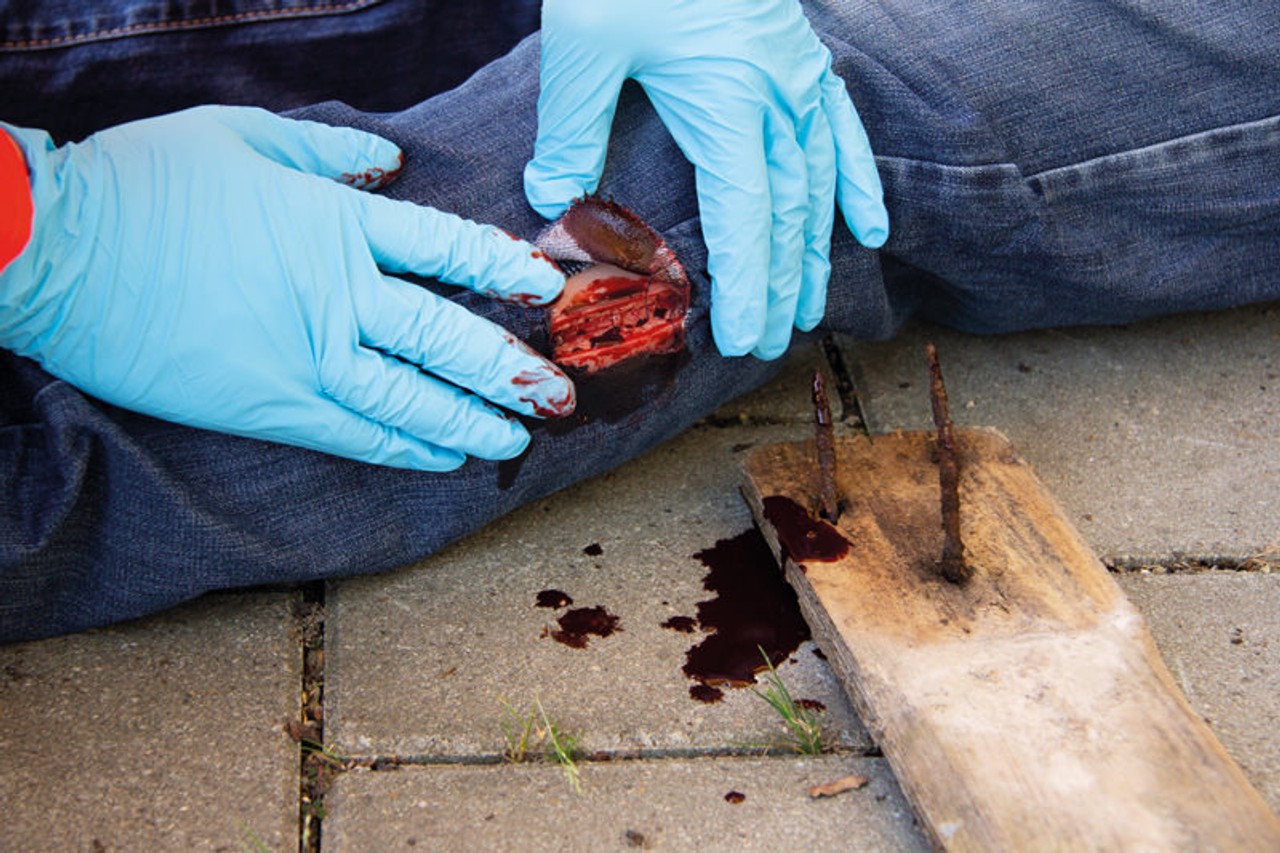 Skin Moulage, Cut Wound