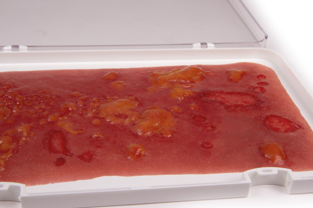 Skin Moulage, Large 2nd Degree Burn Wound
