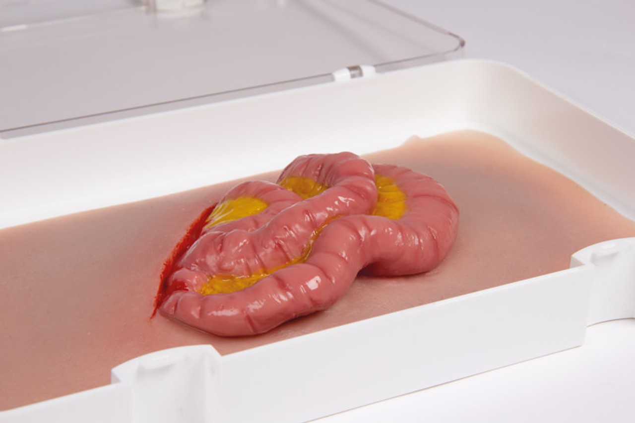 Skin Moulage, Protrusion of Small Intestines