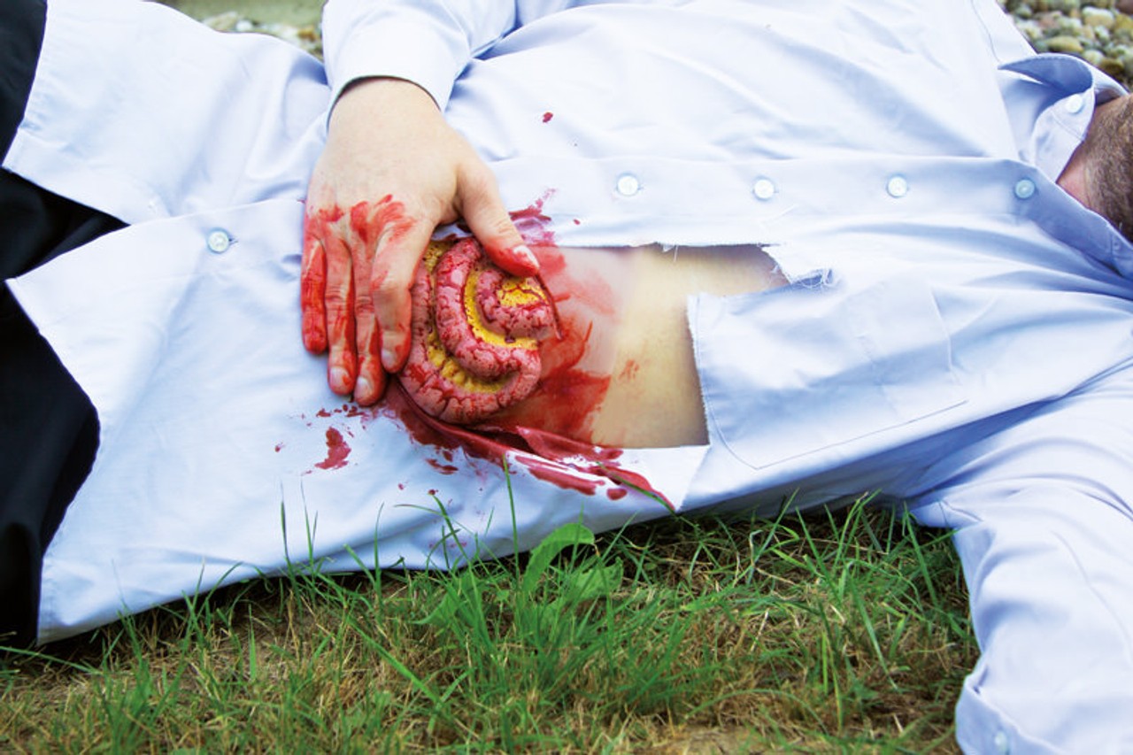 Skin Moulage, Protrusion of Small Intestines