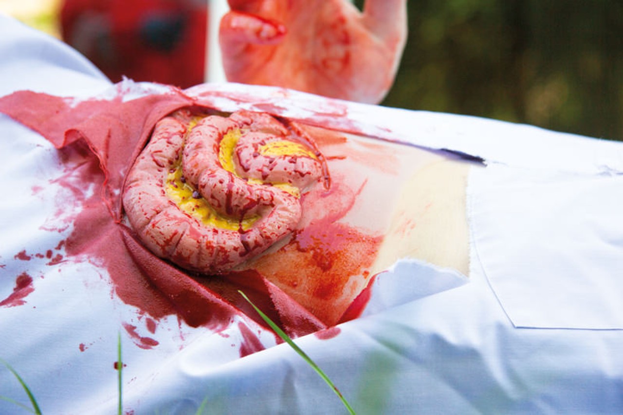 Skin Moulage, Protrusion of Small Intestines