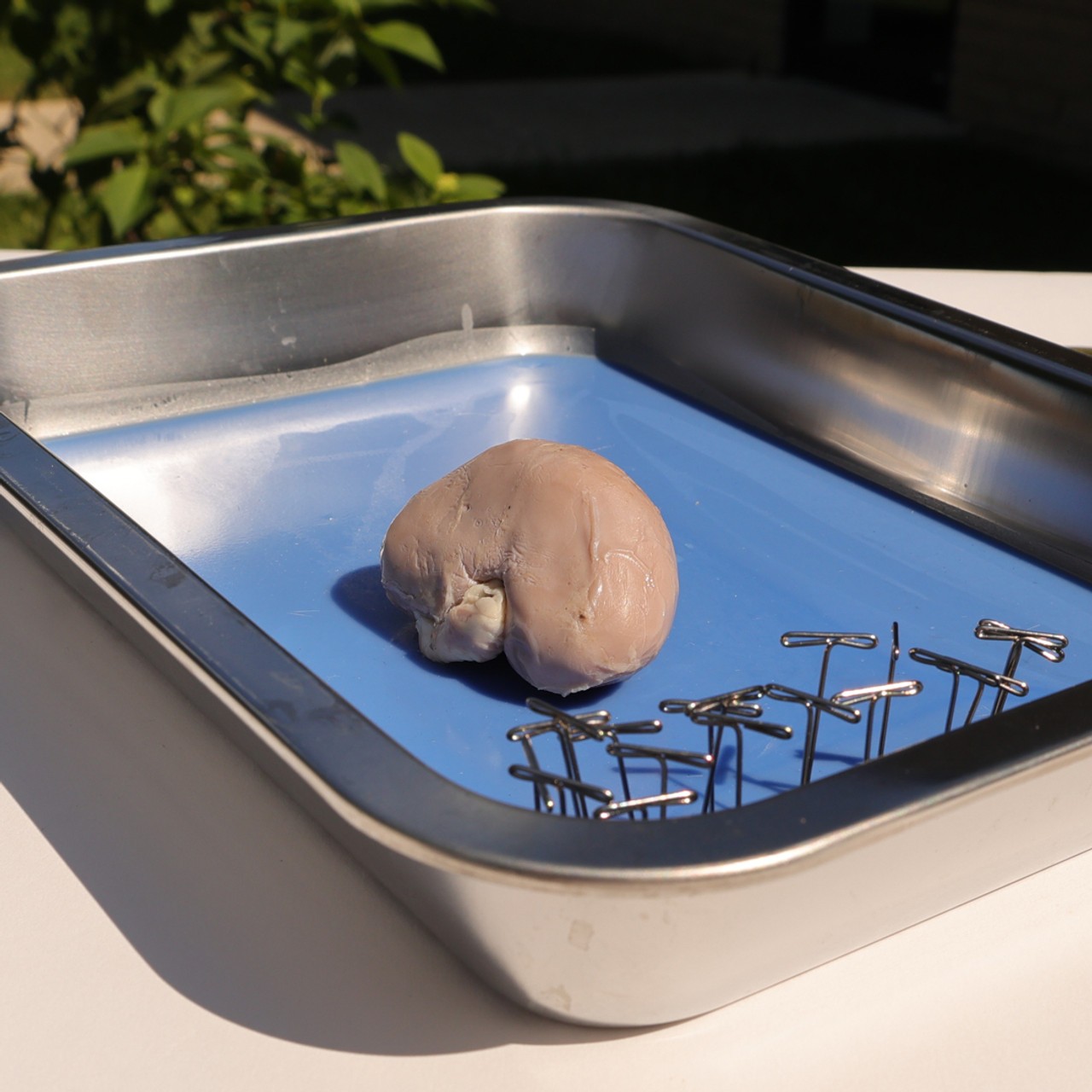 Image of the kidney being dissected